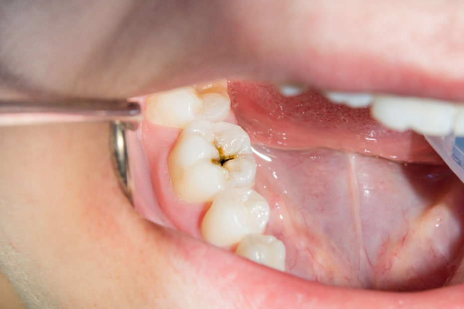 paciente-femenina-joven-escuchando-a-su-dentista